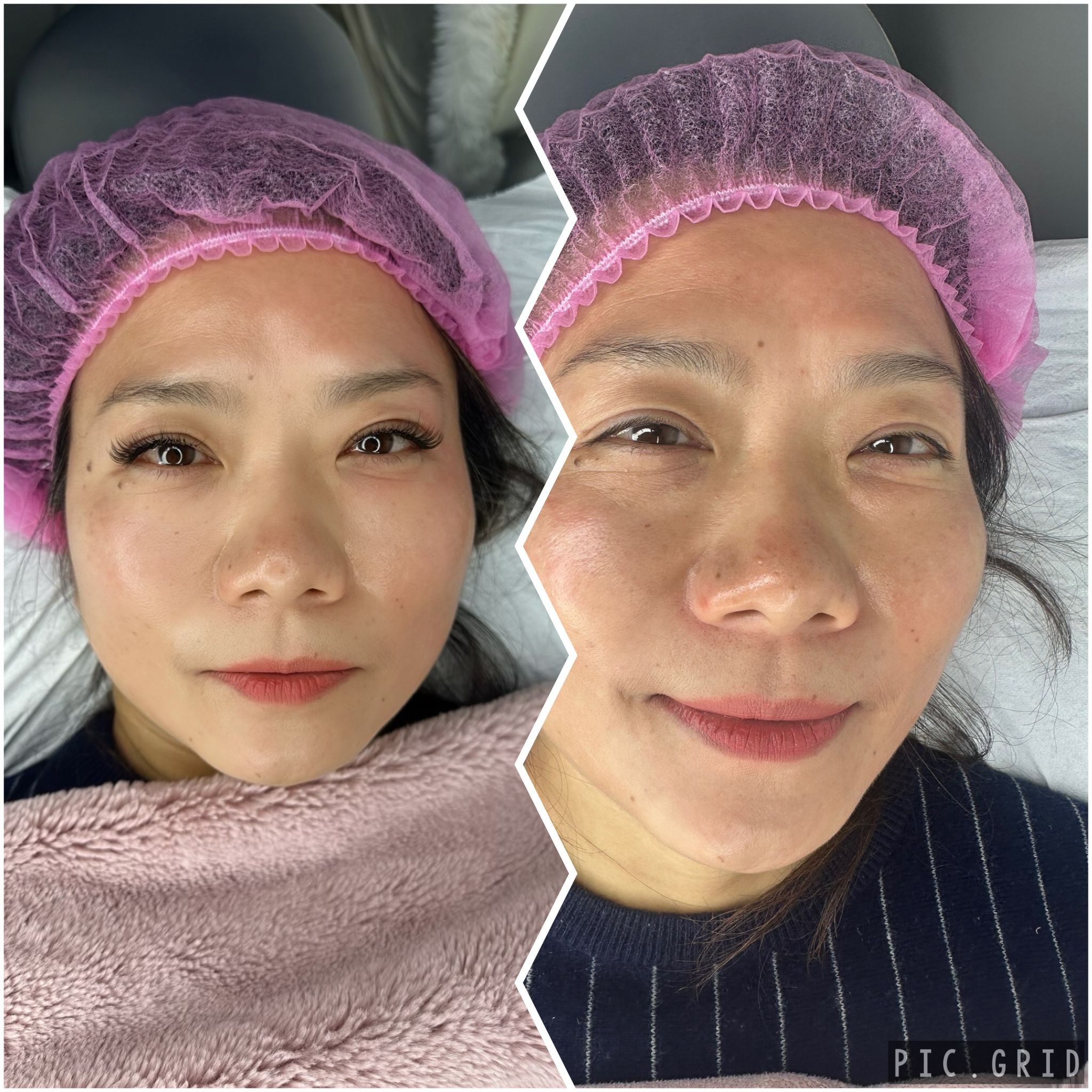 eyelash-extensions-chinese-before-after